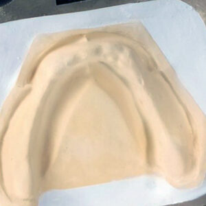 Gipsuri clasa a II -a