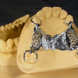 Gipsuri clasa a V -a